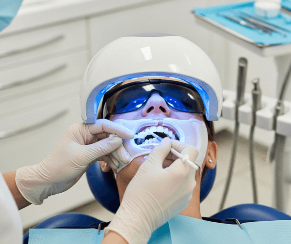 How Teeth Whitening Works and What to Expect from the Process